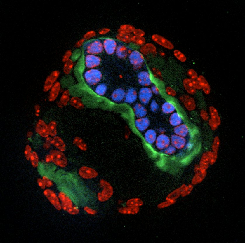 3D_kidney_mesenchyme