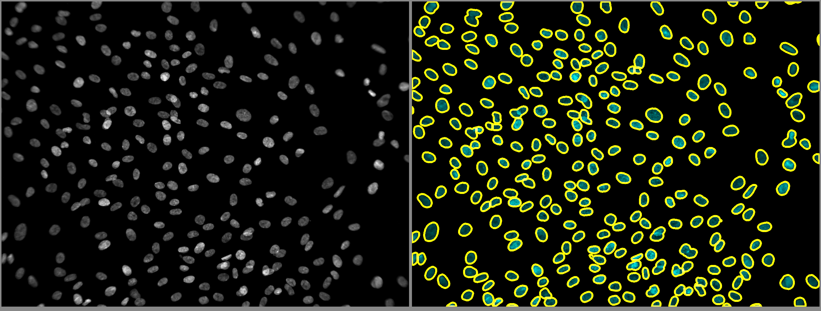 segmentation